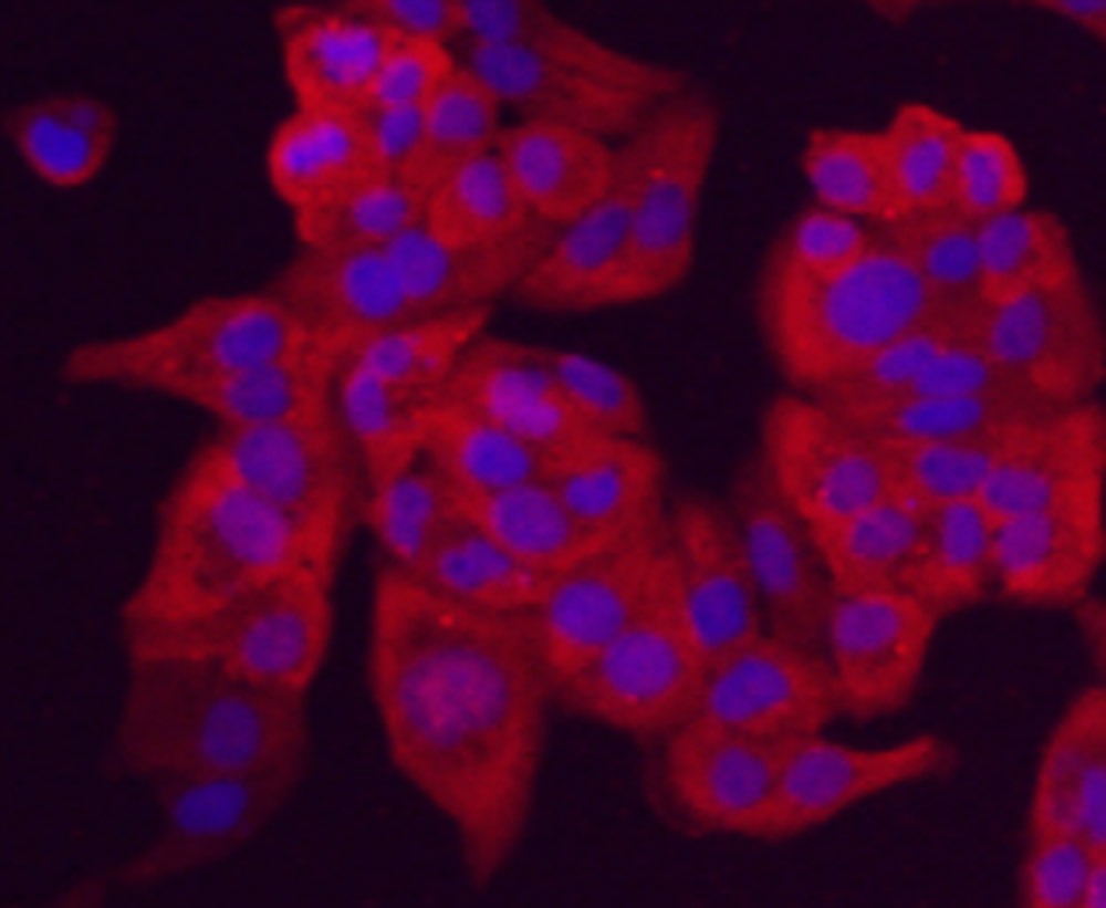 Anti-CHGA Antibody (5H899)