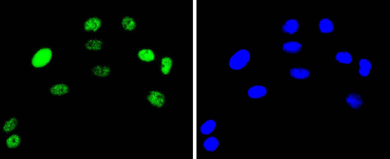 Anti-JUN Antibody (7A403)