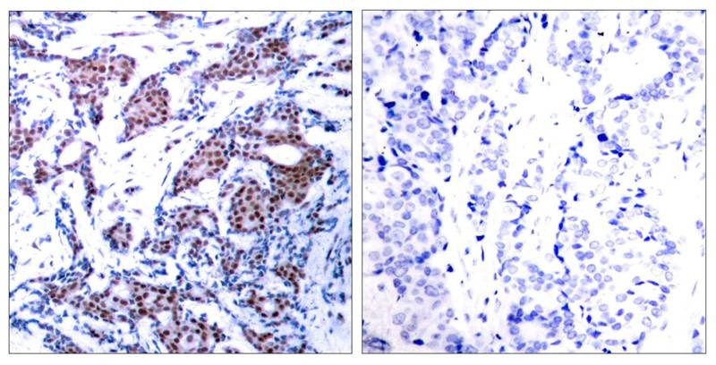 Anti-Phospho-JUN (Ser73) Polyclonal Antibody