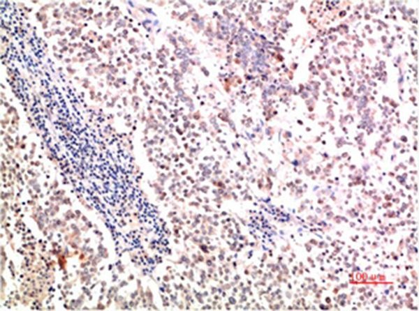 Anti-Collagen II/COL2A1 Antibody (1R829)