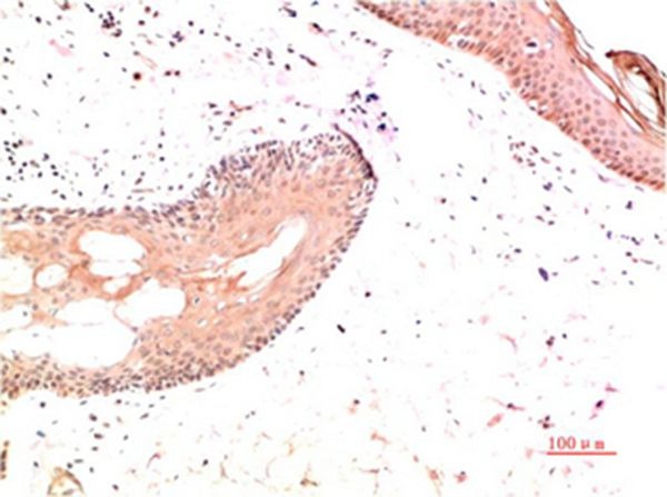 Anti-Collagen I Antibody (1T56)