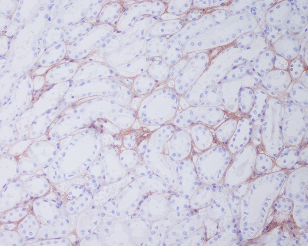 Anti-Collagen I Antibody (7K155)
