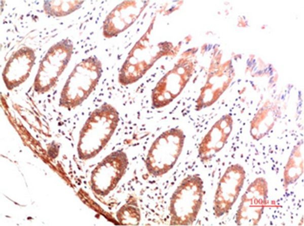 Anti-Collagen I Antibody (4T545)