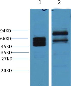 Anti-KRT8 Antibody (6W904)