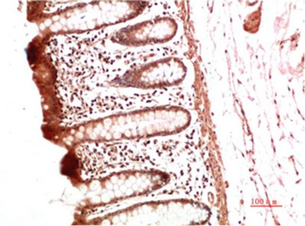 Anti-Collagen II/COL2A1 Antibody (1R829)