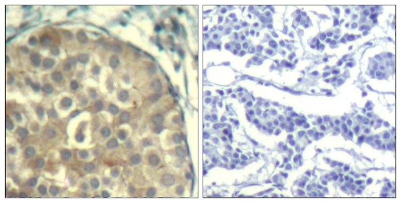 Anti-Phospho-Cofilin (Tyr88) Polyclonal Antibody