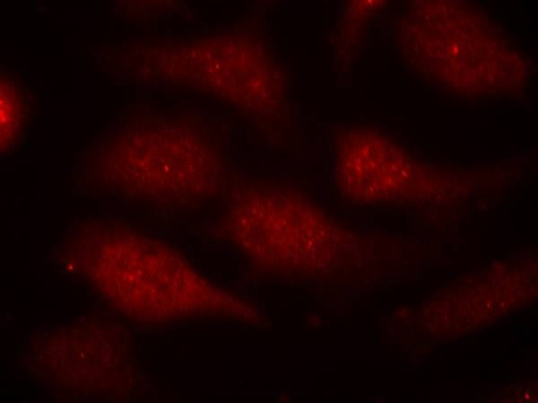Anti-Phospho-CDK6 (Tyr24) Polyclonal Antibody