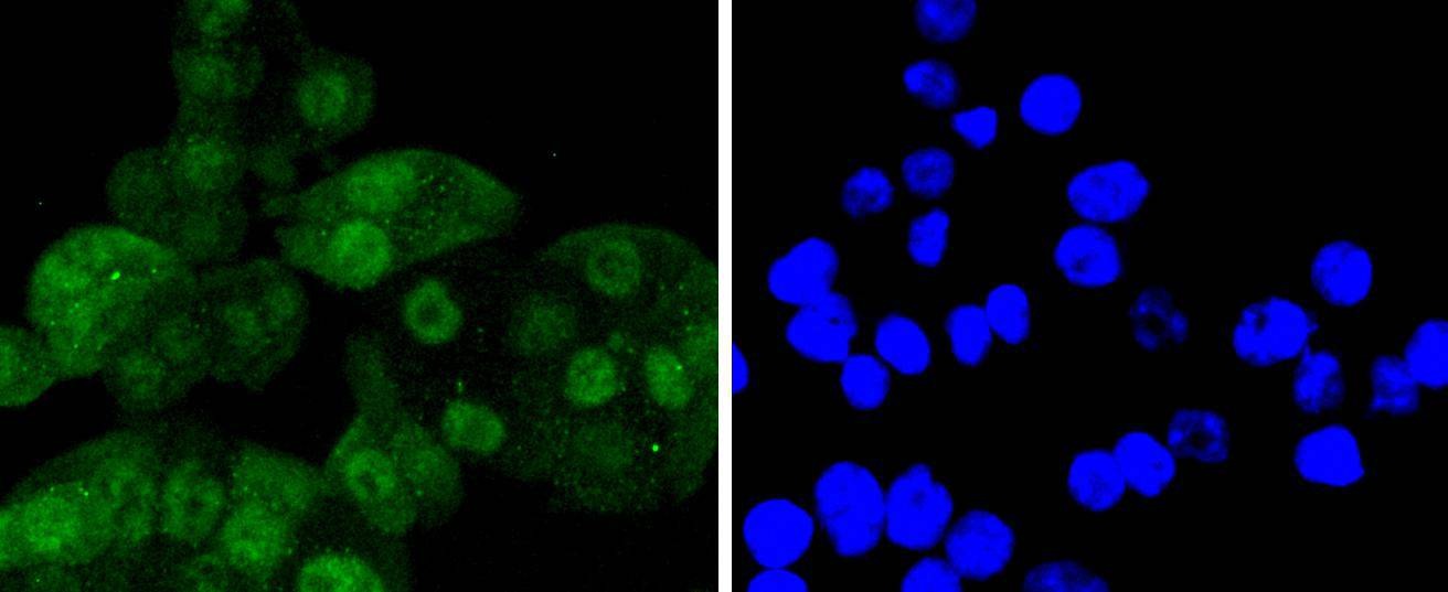 Anti-CDK6 Antibody (5T828)
