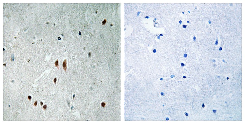 Anti-Phospho-CNOT2 (Ser101) Polyclonal Antibody