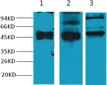 Anti-CK17 Antibody (5Z868)