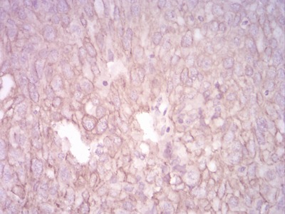 Anti-KRT5 Antibody (8E980)