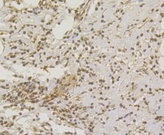Anti-CHD1L Antibody (7L400)