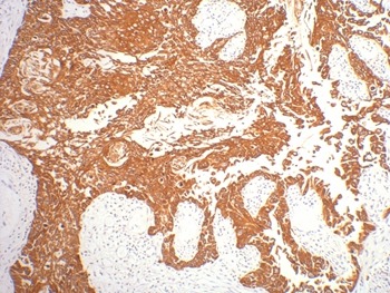 Anti-KRT16 Antibody (5M214)