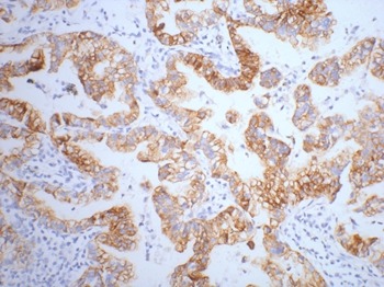 Anti-KRT7 Antibody (6S321)