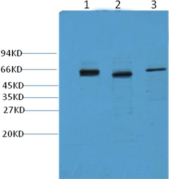 Anti-KRT7 Antibody (6S321)
