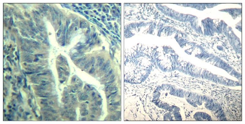 Anti-Phospho-CDK6 (Tyr24) Polyclonal Antibody