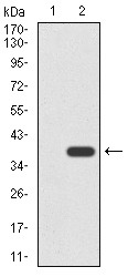 Anti-KRT5 Antibody (8E980)