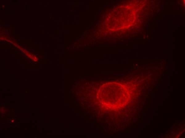 Anti-Phospho-Cofilin (Ser3) Polyclonal Antibody 2