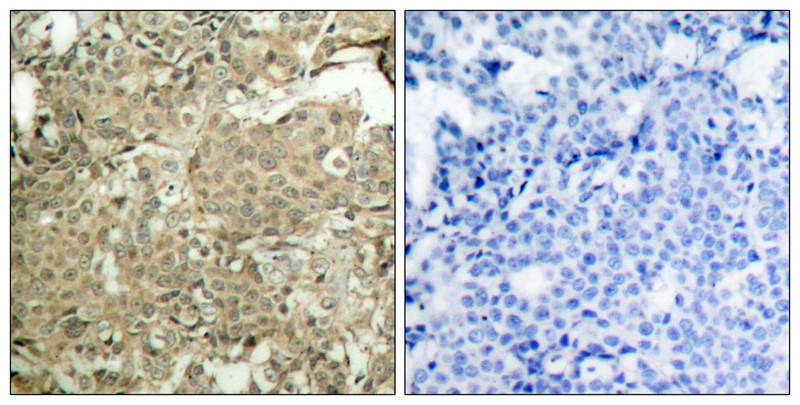 Anti-Phospho-Cofilin (Ser3) Polyclonal Antibody 2