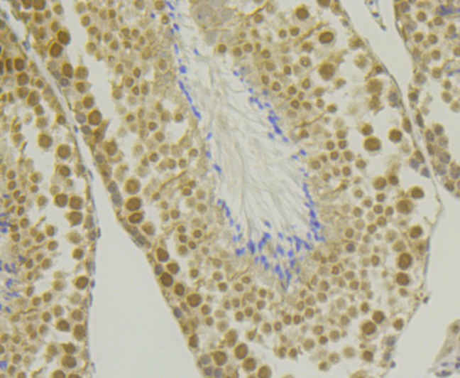 Anti-CHD1L Antibody (7L400)