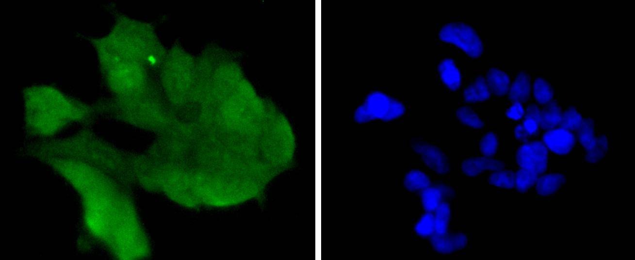 Anti-CDK6 Antibody (5T828)