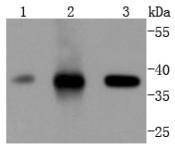 Anti-CDK6 Antibody (5T828)
