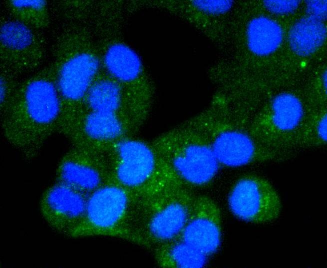 Anti-CHEK1 Antibody (6N369)