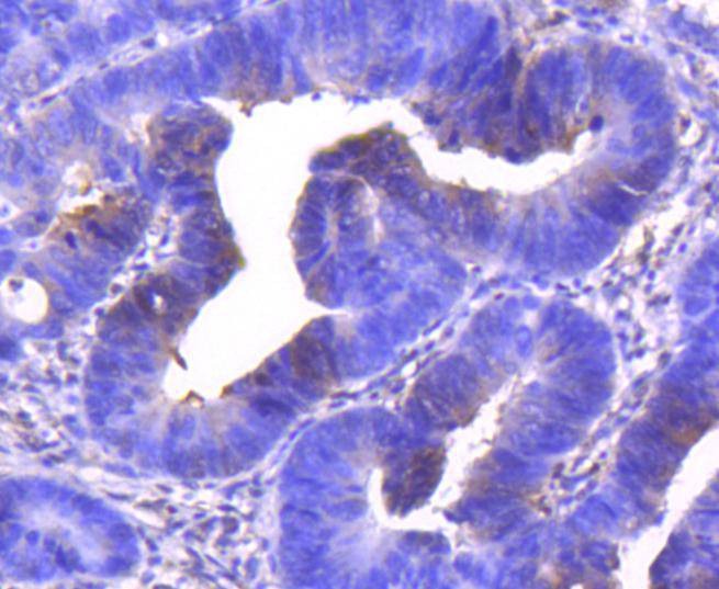 Anti-CDK6 Antibody (5T828)