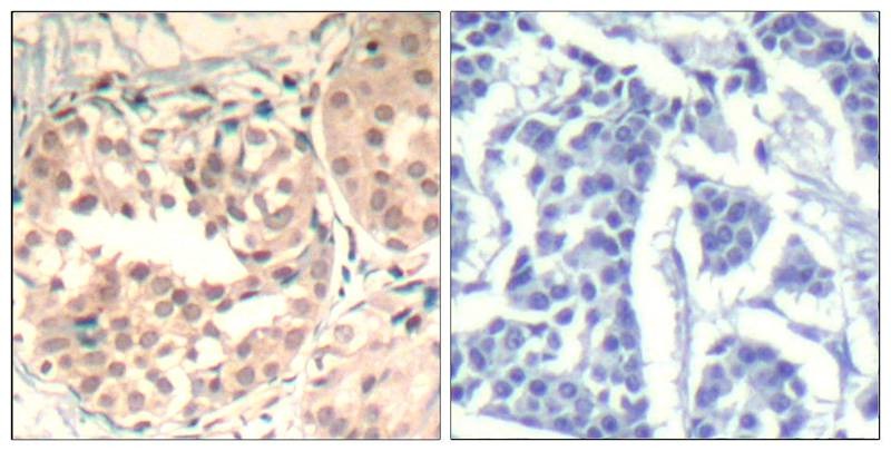 Anti-Phospho-CDK6 (Tyr13) Polyclonal Antibody