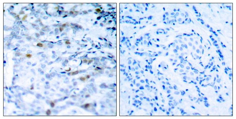 Anti-Phospho-CDK1 (Thr161) Polyclonal Antibody 2