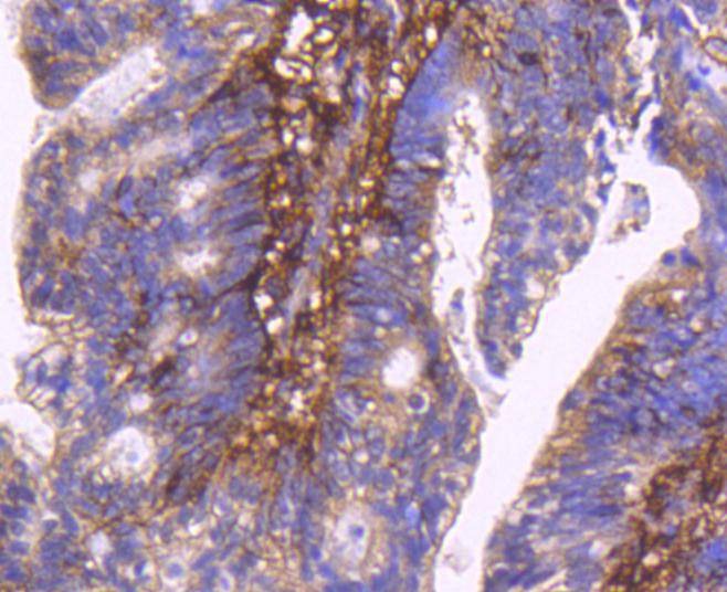 Anti-CD44 Antibody (5M235)