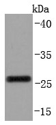 Anti-CD99 Antibody (5Q457)