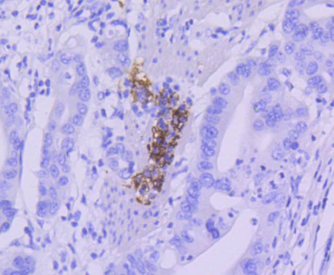 Anti-CD21 Antibody (2Z920)