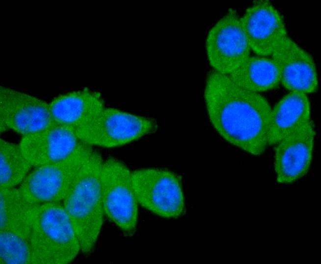 Anti-CD21 Antibody (2Z920)
