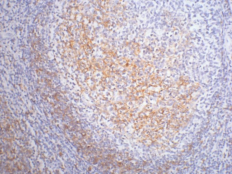 Anti-CD23 Antibody (6Q789)