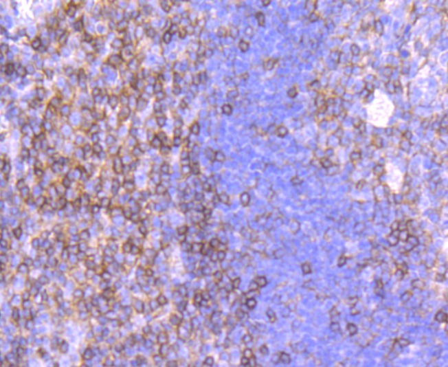 Anti-CD99 Antibody (5Q457)
