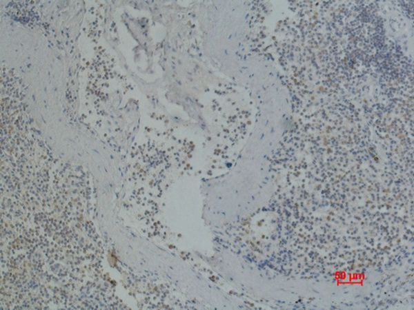 Anti-CD41 Antibody (1O322)