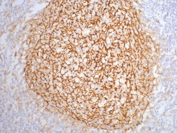 Anti-CD21 Antibody (5G799)