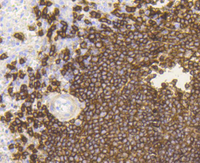 Anti-CD20 Antibody (9T986)