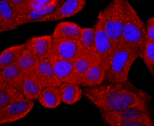 Anti-CD99 Antibody (5Q457)