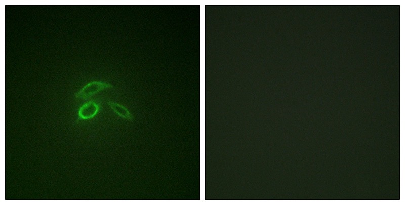 Anti-Phospho-Mucin-1/MUC1 (Tyr1229) Polyclonal Antibody 2