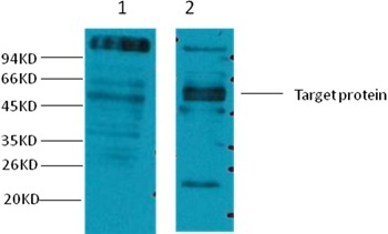 Anti-CD23 Antibody (6P362)