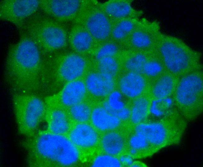 Anti-CD86 Antibody (5O340)