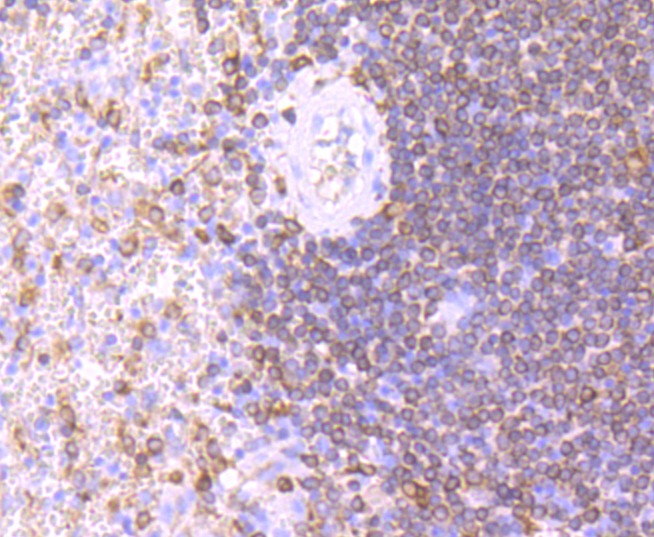 Anti-CD74 Antibody (9A482)
