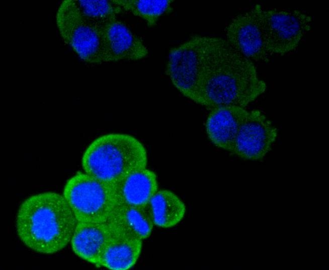 Anti-ITGAL Antibody (1J385)