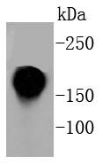 Anti-ITGAL Antibody (1J385)