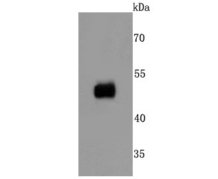 Anti-FCGR2A Antibody (8G444)