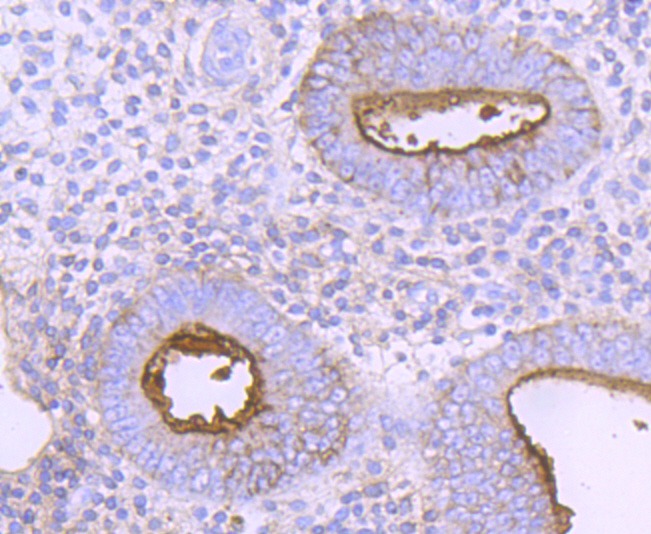 Anti-NT5E Antibody (1N164)