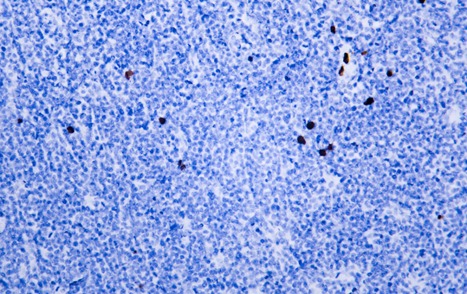 Anti-CD8 alpha Antibody (2N656)