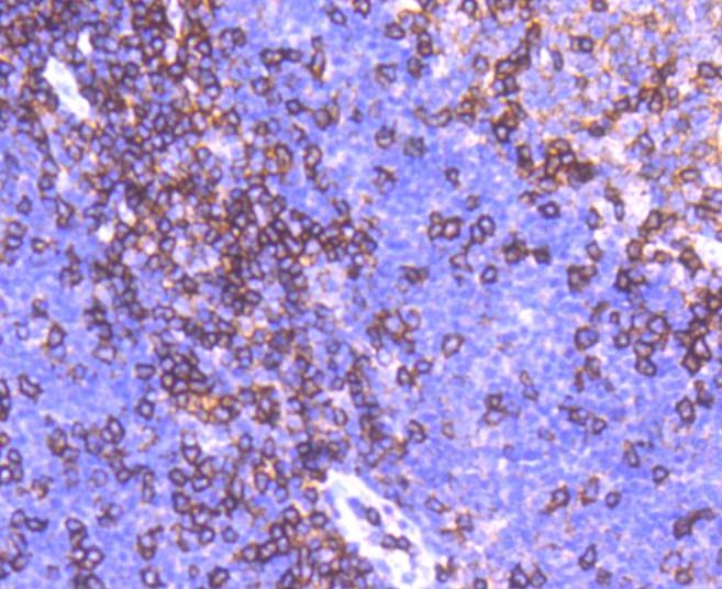 Anti-ITGAL Antibody (1J385)